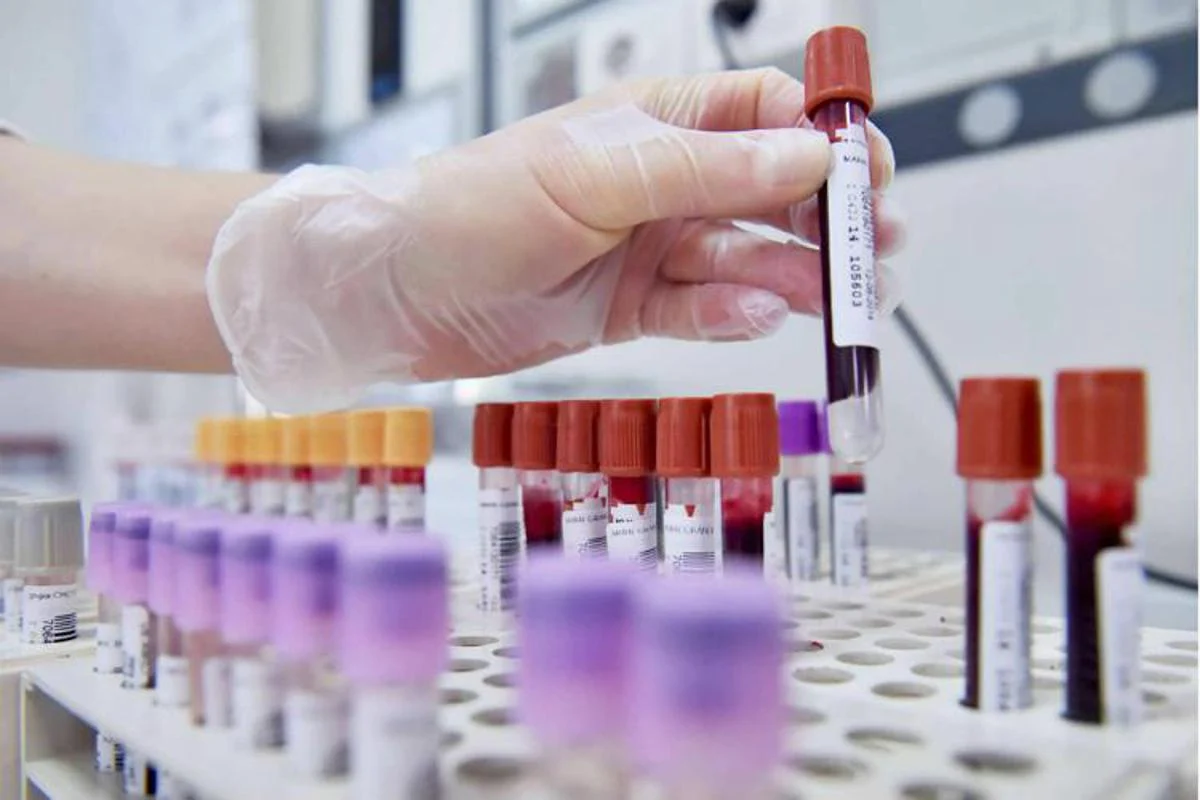 Hiv, dalla Sicilia il modello per estendere terapie long acting