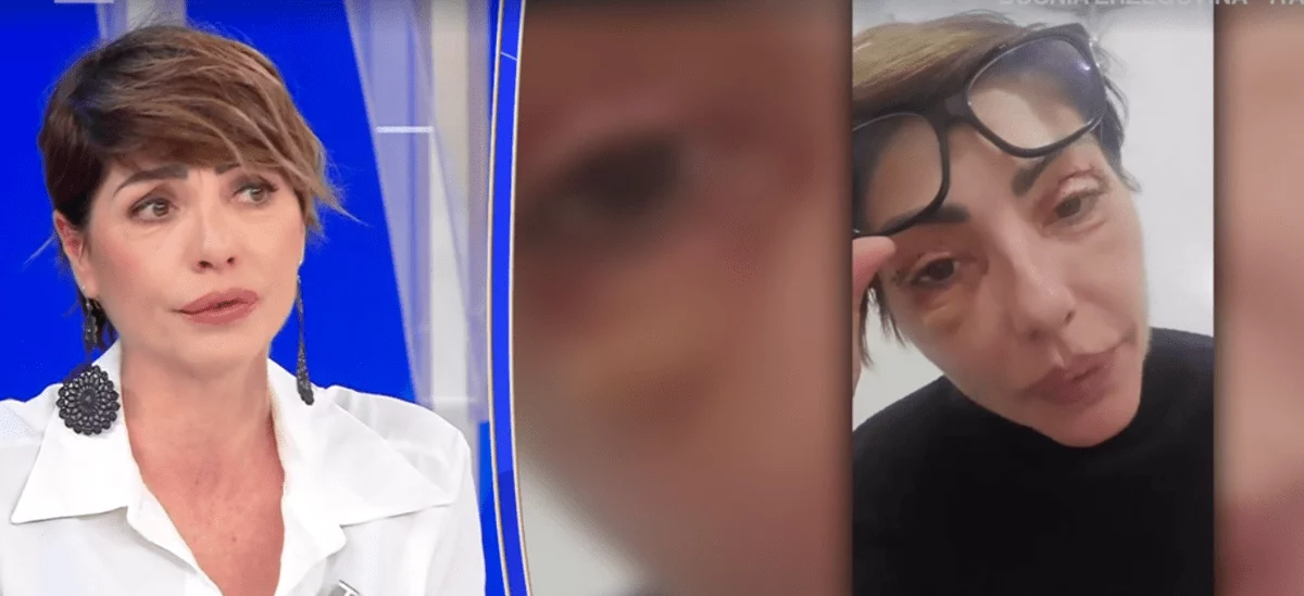 Ilaria Galassi, insulti social per i ritocchi estetici: “Offese anche sui miei figli”