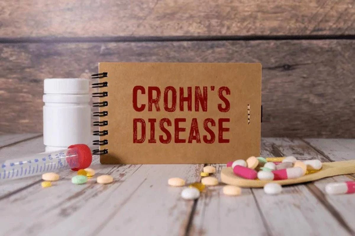 Malattia Crohn con fistole, nuovi dati su terapia monoclonale